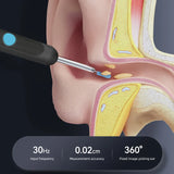 Intelligenter visueller Ohrenreiniger mit Minikamera